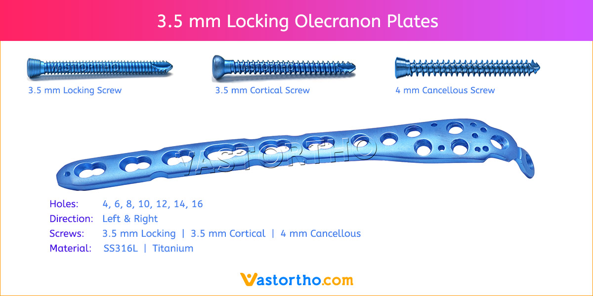 3.5 mm Locking Olecranon Plates