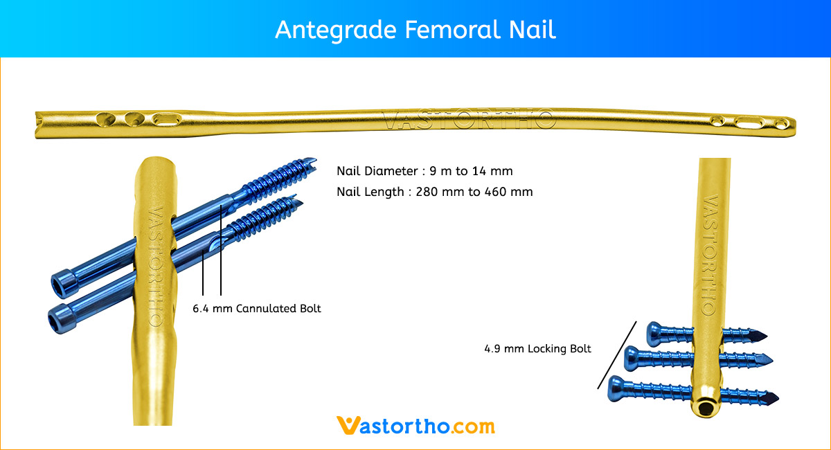 Interlocking Long PFN Nail