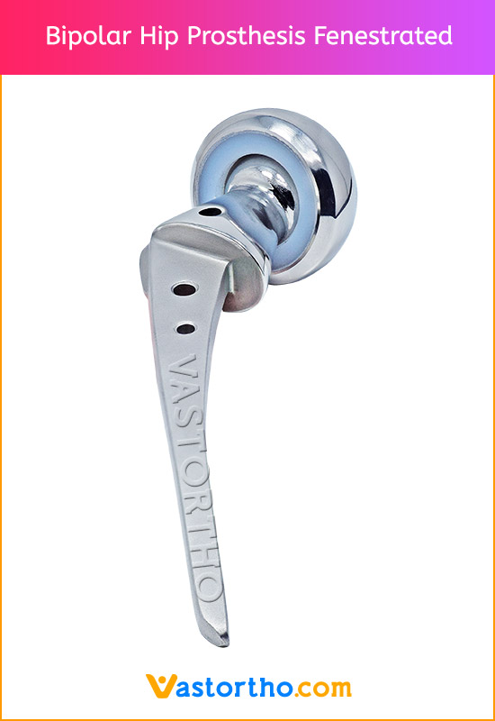 Bipolar Hip Prosthesis Fenestrated