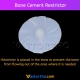 Bone Cement Restrictor