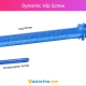 Dynamic Hip Screw