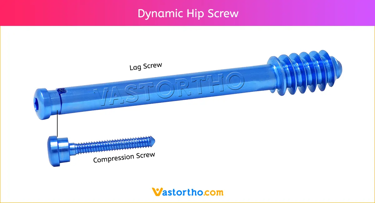 Dynamic Hip Screw Uses, Sizes & Surgical Technique • Vast Ortho