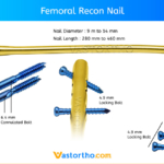 Femoral Recon Nail