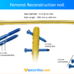 Femoral Reconstruction nail