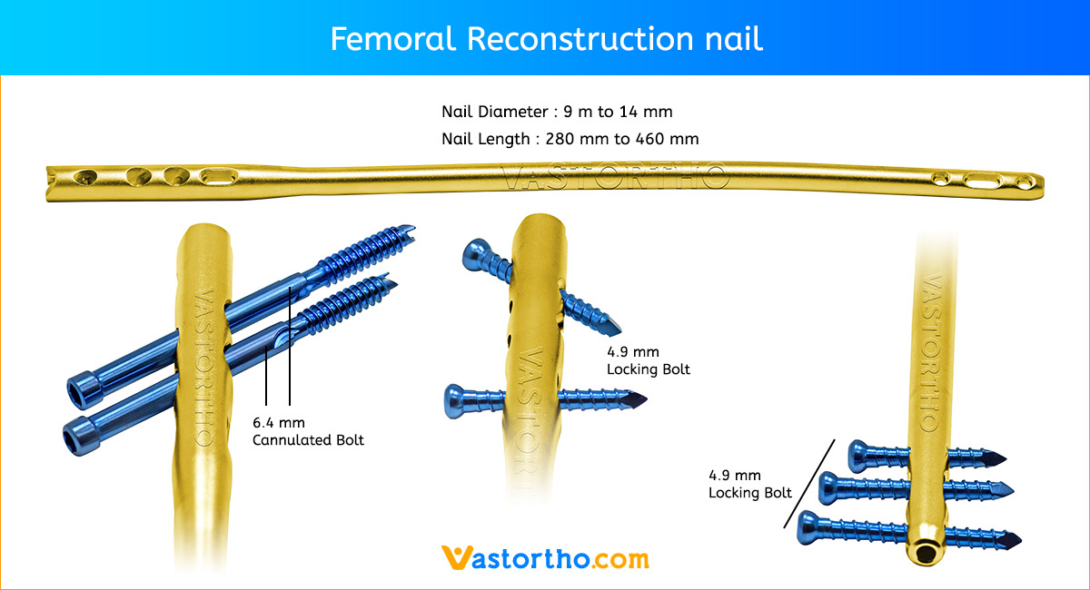 Femoral Reconstruction Nail uses, sizes & surgical technique • Vast Ortho Femoral Reconstruction Nail uses, sizes & surgical technique • Vast Ortho