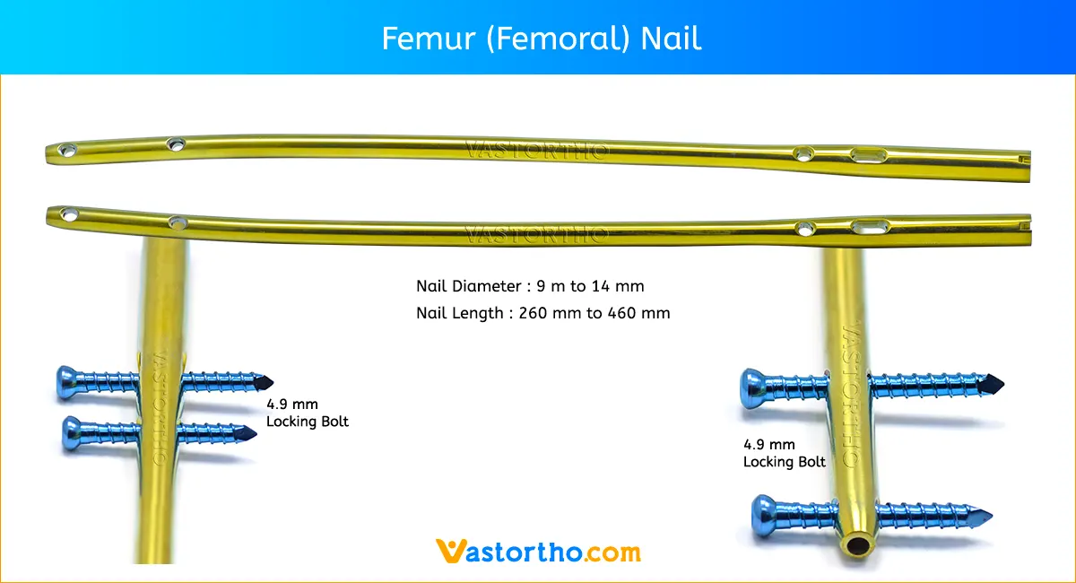 TROCHANTERIC FEMORAL NAIL (T.F.N.) (130° & 135°) – Nebula Surgical Pvt. Ltd.