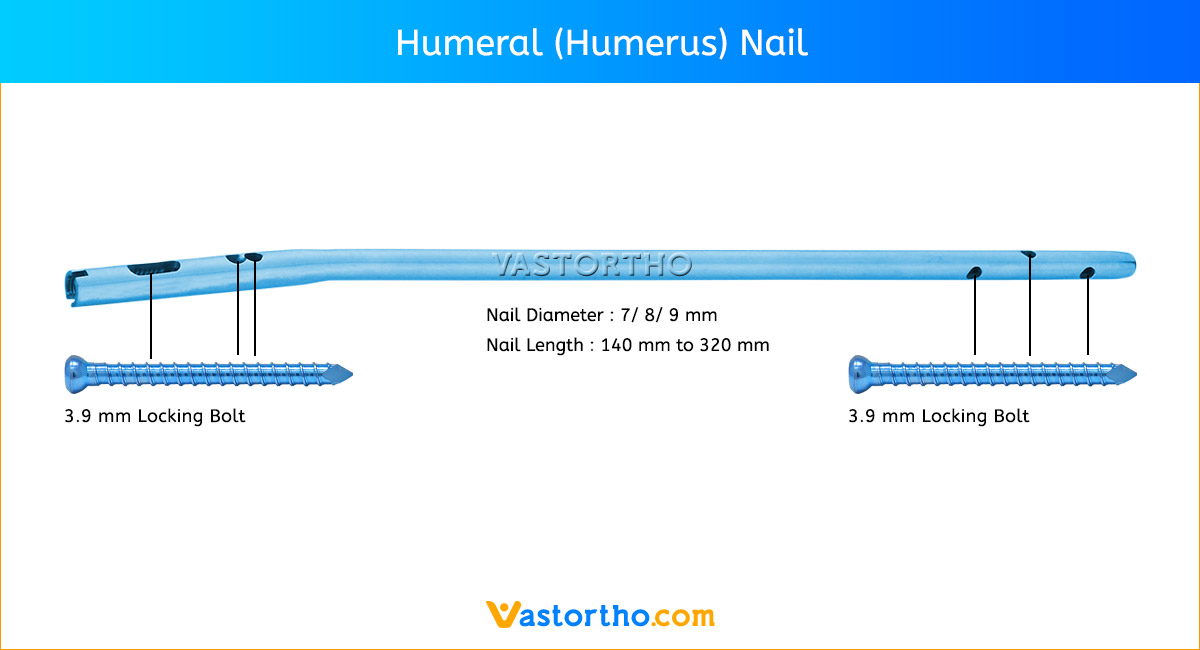 PFN Nail (Proximal Femoral Nail) Uses & Sizes • Vast Ortho