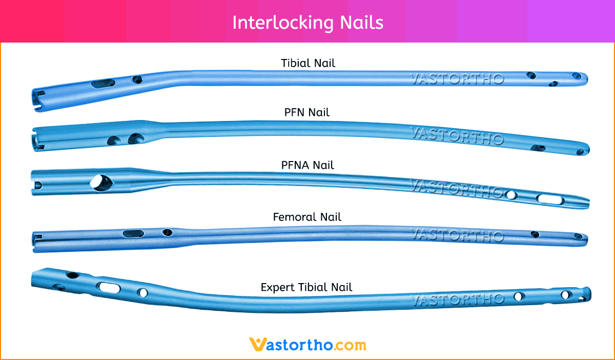 PFNA Proximal Femoral Nail Antirotation,Spiral Blade With Distal Aiming  Arm,Cannulated,Medical Device Manufacturers -Double Medical