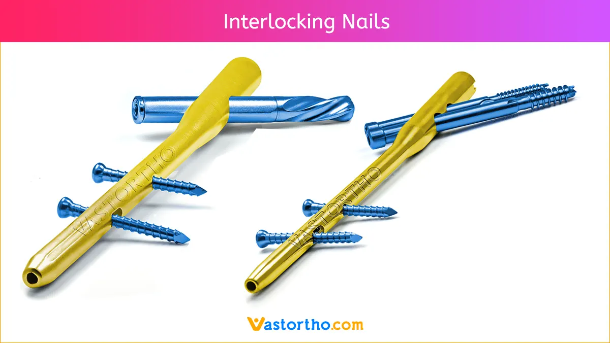 Interlocking Nails