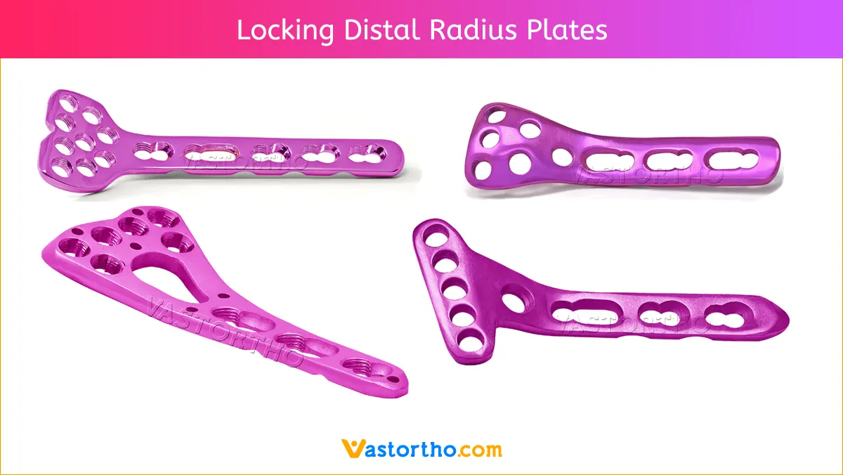 Locking Distal Radius Plates