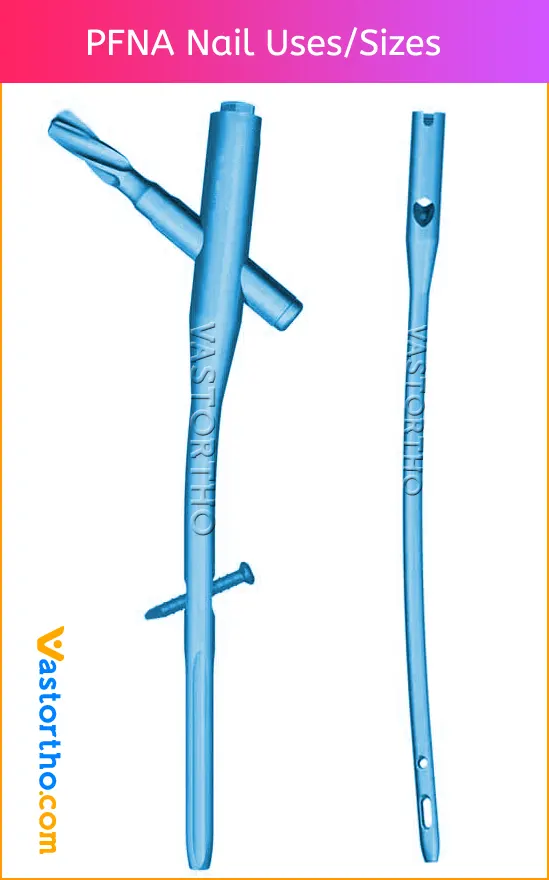 PFNA Nail Uses Sizes