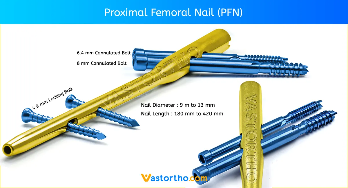 Proximal Femur Nail in Intertrochanteric Fractures Indications and  Tips/Tricks - MedCrave online
