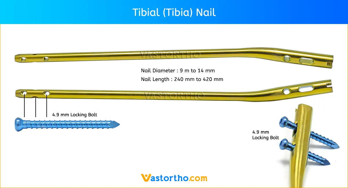 A comparative biomechanical study of the Distal Tibia Nail against  compression plating for the osteosynthesis of supramalleolar corrective  osteotomies | Scientific Reports